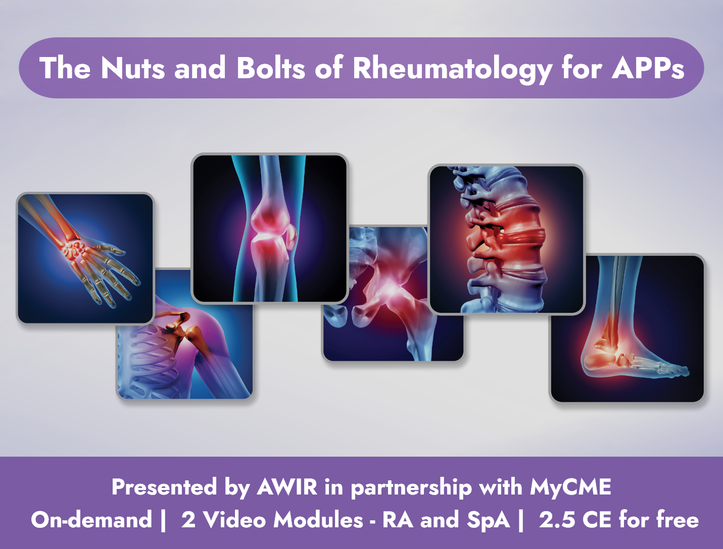 Register for AWIR 2024